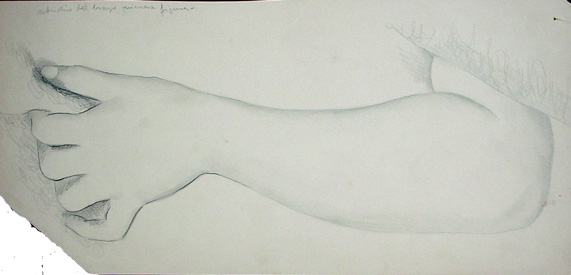 Arm